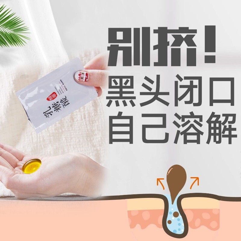 如何查看面部的历史价格|面部价格走势