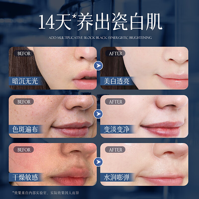 维特丝377面霜保湿补水美白男女士护肤品水乳祛斑提亮肤色化淡黑色素 【98%选择】美白淡斑丨敏肌*2