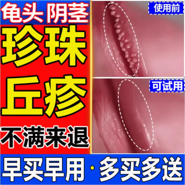 一盒适用装【龟头珍珠丘疹透明小肉粒】