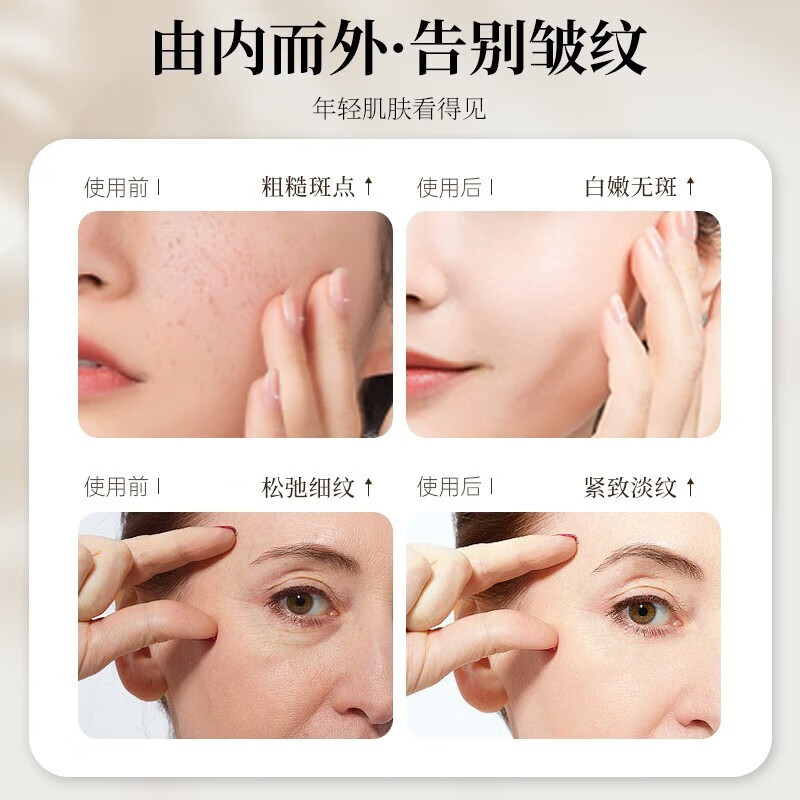 xovo黄金胶原蛋白面膜深层补水保湿抗皱淡化细纹提拉紧致提亮肤色 3盒/15片【弹润光滑保湿】