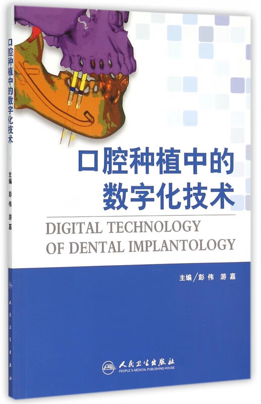 口腔种植中的数字化技术