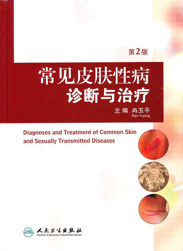 常见皮肤性病诊断与治疗【正版书籍】