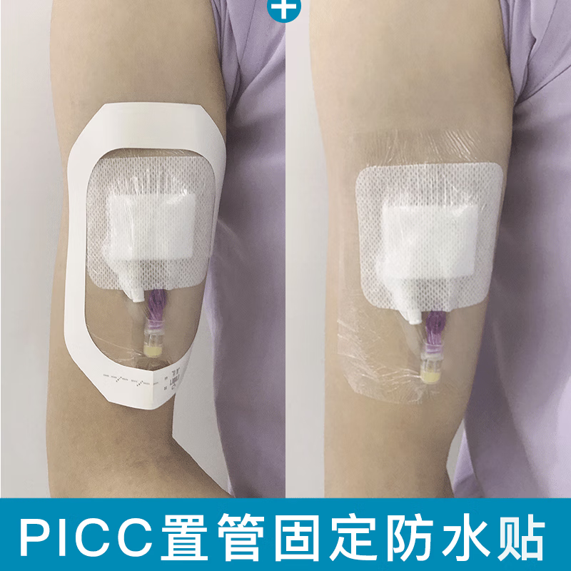 妥能医用pu透明敷料贴picc静脉导管固定贴输液留置针透明贴 10cm*12cm