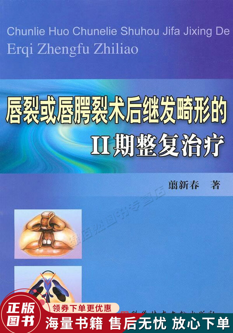 唇裂或唇腭裂术后继发畸形的2期整复治疗