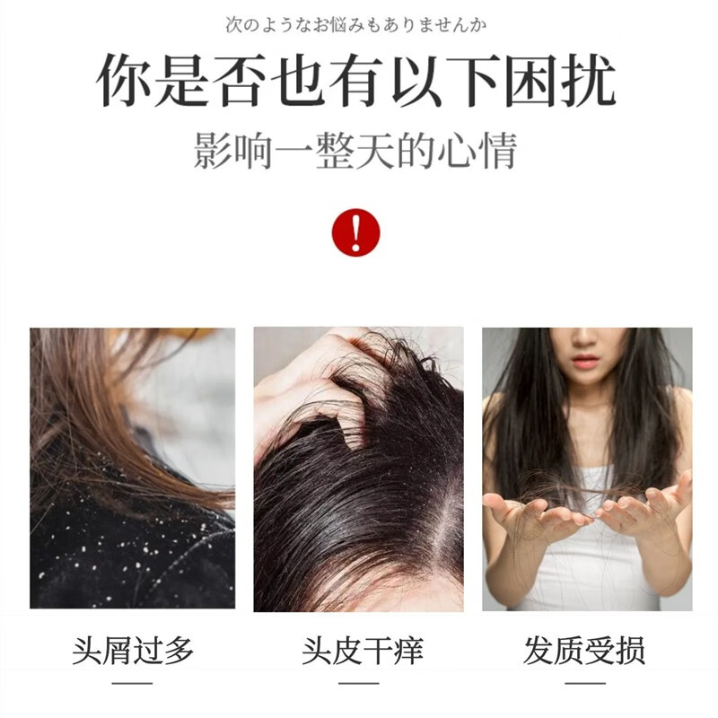 SOOFELIFE舒芬妮马油茶麸去屑止痒洗发乳900g调节水油平衡去屑控油洗发水 茶麸去屑止痒洗发水900g*1支