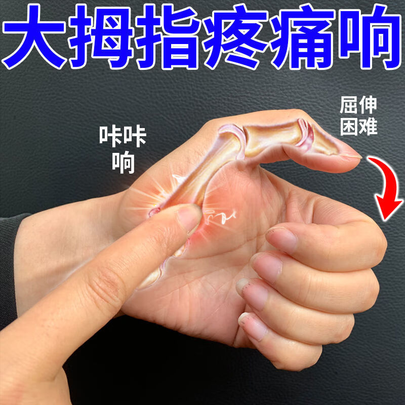 【最快一天】手指腱鞘炎手指手腕弯曲疼痛无力腱鞘囊肿鼓包弹响痛鼓包