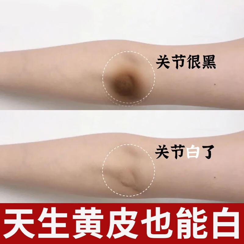 美颜笔记关节去除黑膝盖手指全身去角质胳膊肘腋下手肘变白身体净化素