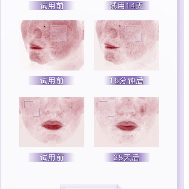 配方师的告白【福利】5%传明酸小样5ml*2 5ml*2