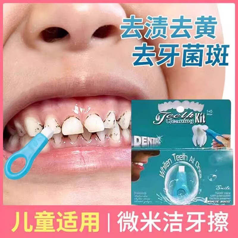 漫婵儿童洁牙擦牙菌斑祛除色素沉淀牙齿清洁牙渍牙垢去除黑斑黑牙神器