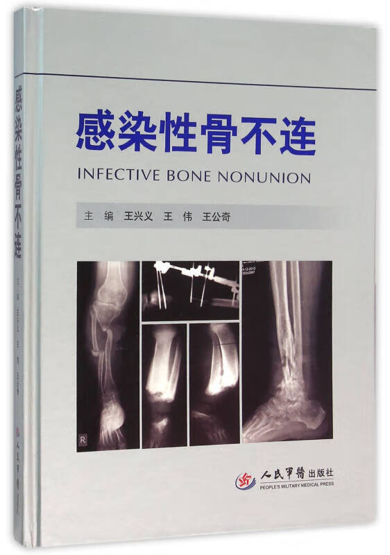感染性骨不连【正版书籍,畅读优品】