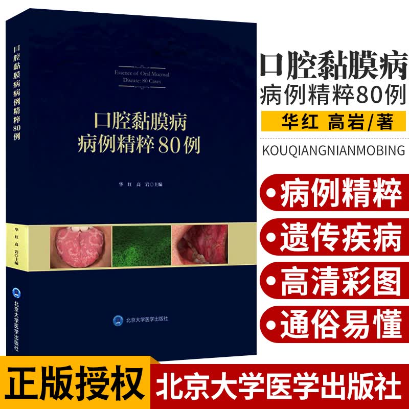 口腔黏膜病病例精粹80例 口腔医学 口腔粘膜溃疡 感染性疾病 唇舌疾病 遗传性疾病 华红 高岩著