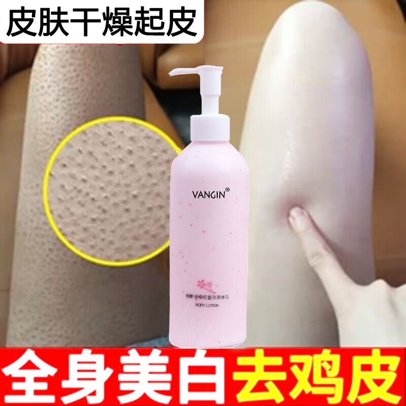 起皮用的身体乳哪款好(冬天身体起皮用什么身体乳) 起皮用的身体乳哪款好(冬天身体起皮用什么身体乳)