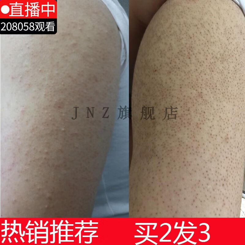 男红血丝鸡皮肤(男性蛋皮上有红色血丝) 男红血丝鸡皮肤(男性蛋皮上有红色血丝)