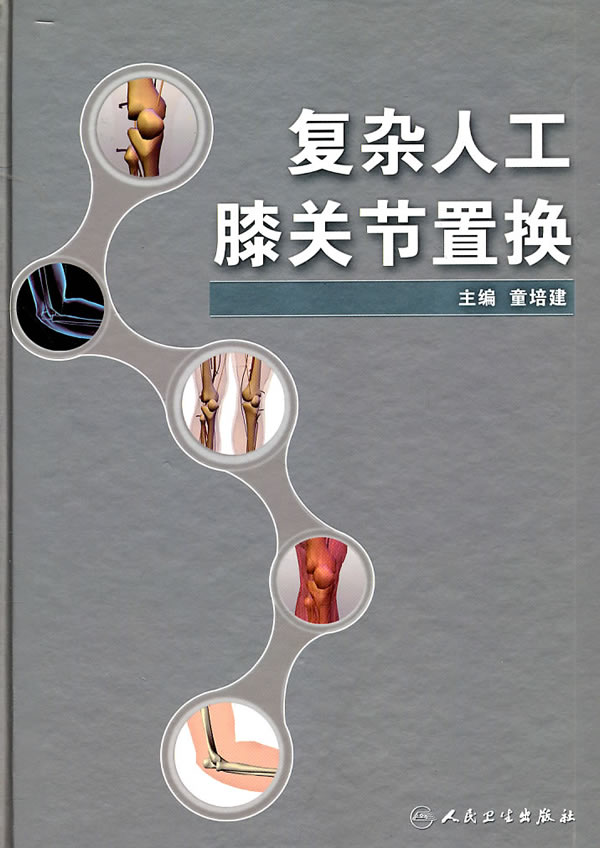 【正版保证】复杂人工膝关节置换 童培建 人民卫生出版社