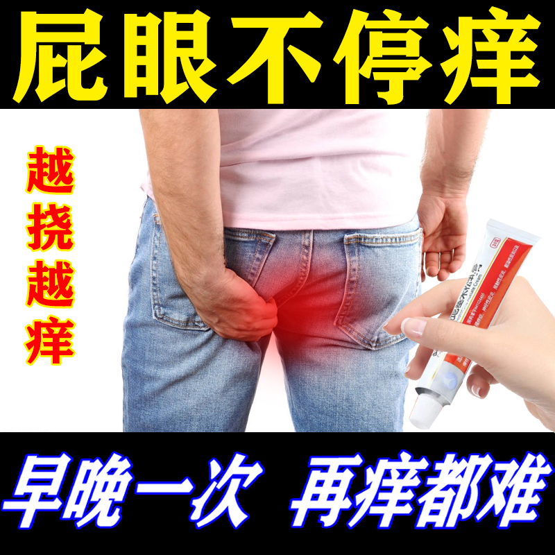 治肛门瘙痒屁眼痒肛周瘙痒药膏私处瘙痒湿疹肛门潮湿红肿潮湿止痒药膏