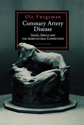 预订Coronary Artery Disease