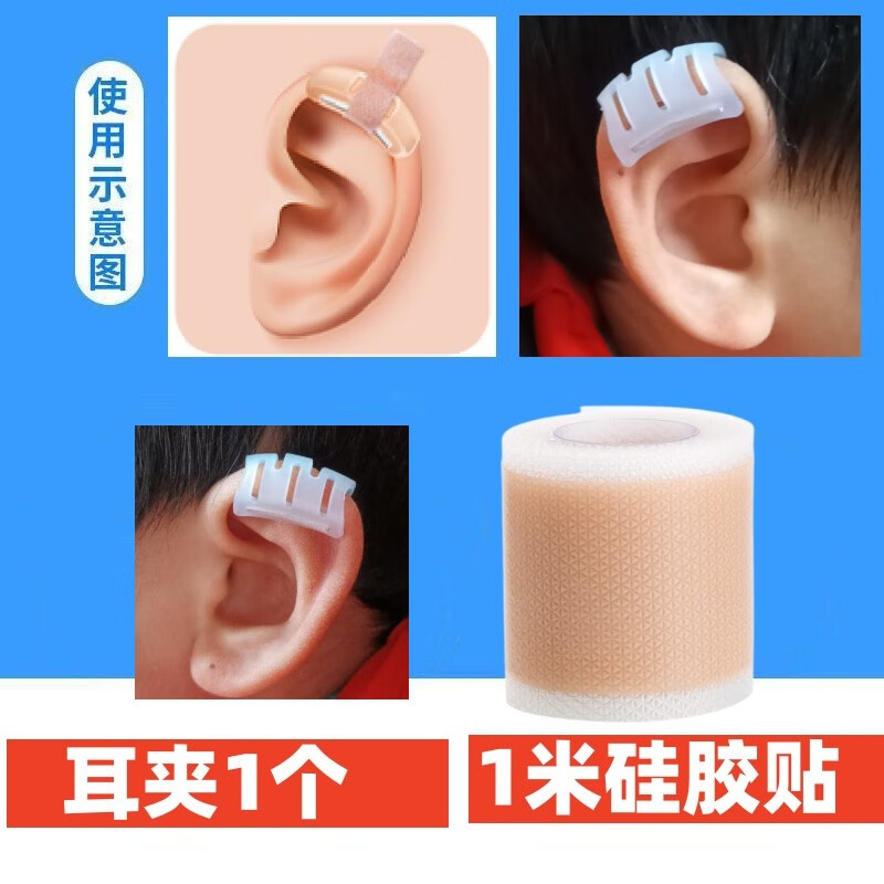 婴儿环缩耳矫正器 新生儿耳朵硅胶贴婴儿耳廓固定定型垂耳支撑耳夹