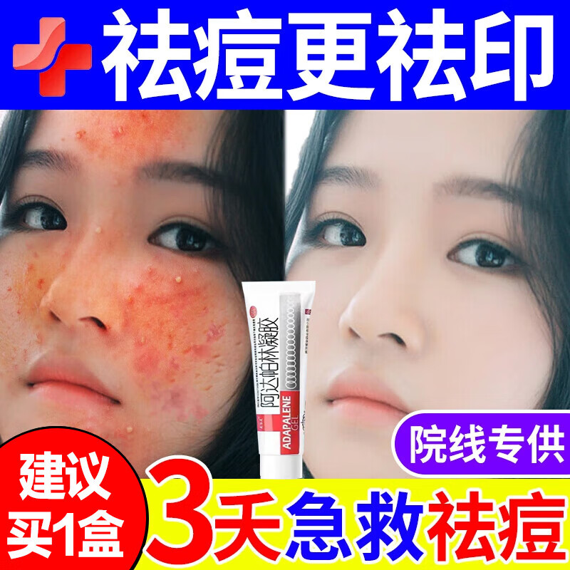 痘印痘坑消炎痤疮痘痘修复消炎痘印医用药膏女孩学生药阿达帕林凝胶 1