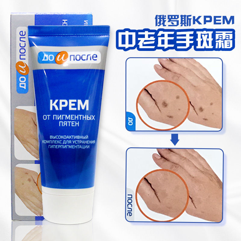去除手上老年斑去手上老年斑手部手背专用俄罗斯kpem护手霜祛除老人斑