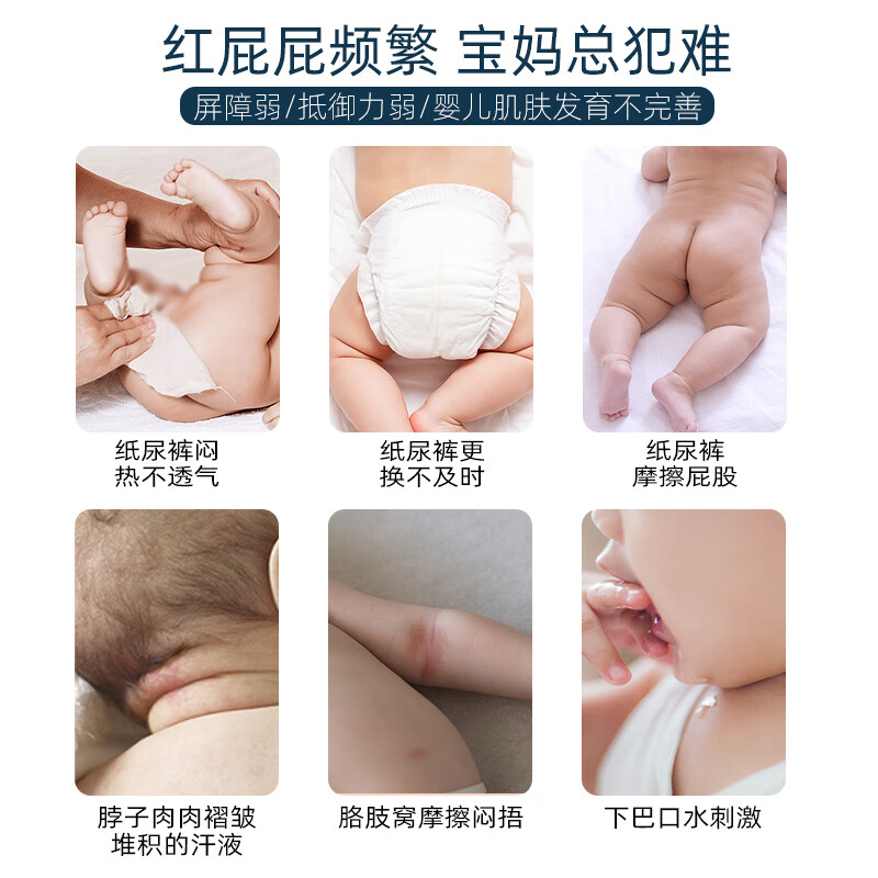 元荣鞣酸软北膏医三院小孩红股红屁屁小儿婴儿护臀膏老人用成人褥疮膏臀部外用压疮溃烂护理软膏 新生儿 护臀膏30g