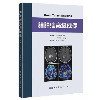 脑肿瘤高级成像【正版图书】