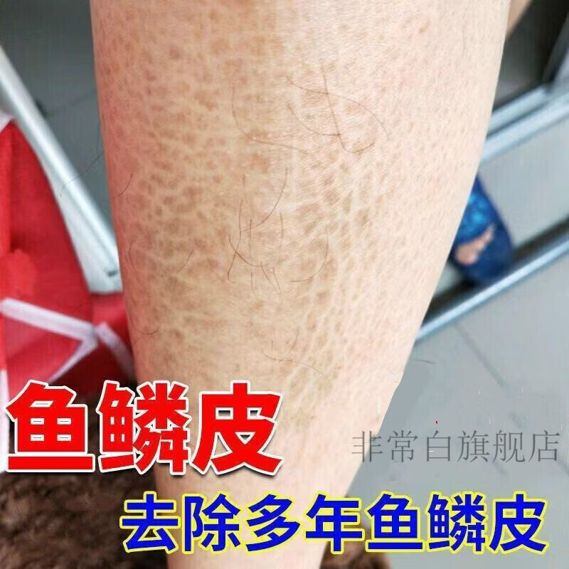 毛孔起鸡皮疙瘩盗汗(毛孔起鸡皮疙瘩盗汗怎么办) 毛孔起鸡皮疙瘩盗汗(毛孔起鸡皮疙瘩盗汗怎么办)