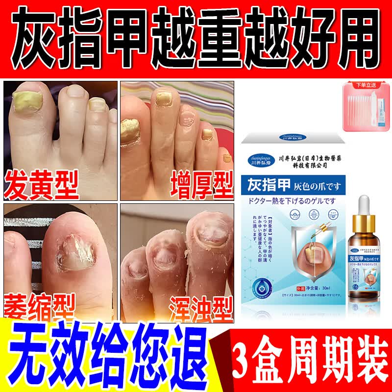 空灰甲专用净根膏治真菌凤仙花抑菌液非药品脱甲甲沟炎指甲菌感染脱甲