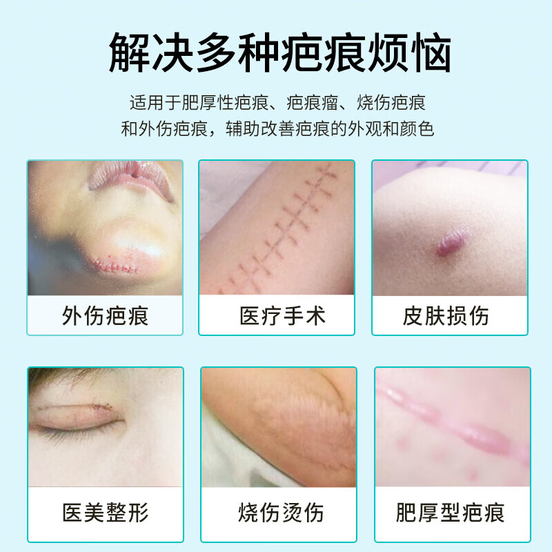 丝芙美疤痕敷料进口医用硅酮疤痕凝胶祛疤膏 医美双眼皮手术修复2.5x2.5 2.5cm*2.5cm