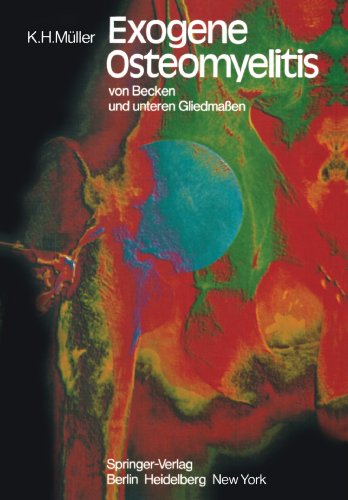 预订 exogene osteomyelitis von becken und unteren gliedmassen