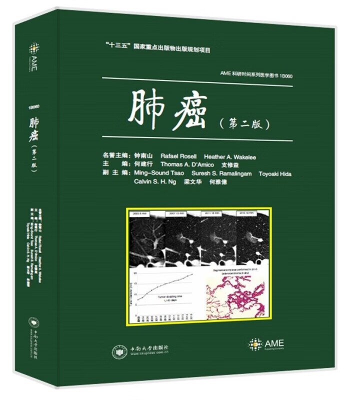 肺癌 （第二版） 中南大学出版社 何建行 著