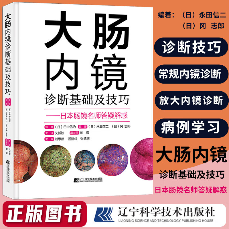 大肠内镜诊断基础及技巧 日本肠镜名师答疑解惑 提高大肠病变的诊断水平 常规内镜诊断 辽宁科学技术出版社