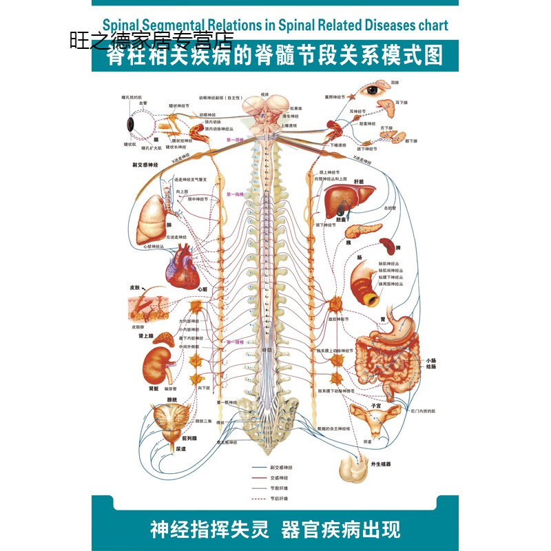 恋品惠脊柱相关疾病脊髓节段关系模式图医院骨科解剖挂图脊椎骨骼肌肉