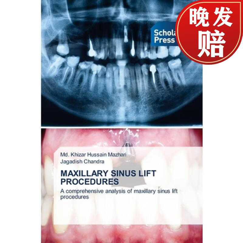 【4周达】maxillary sinus lift procedures
