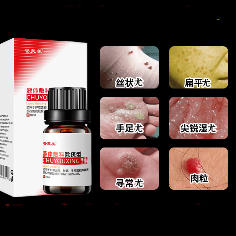 尖锐湿疣检测可搭药品男性女性私处hpv病毒专用丝状疣生殖器疱痒疹