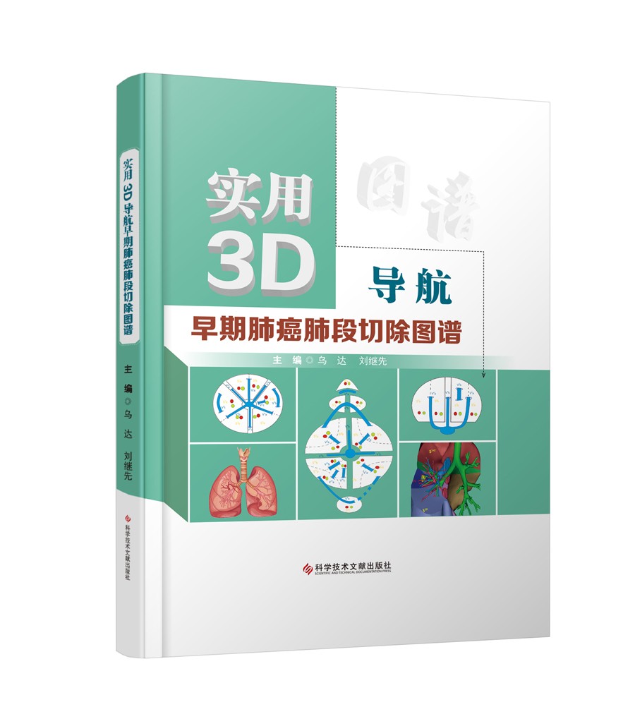 实用3D导航早期肺癌肺段切除图谱