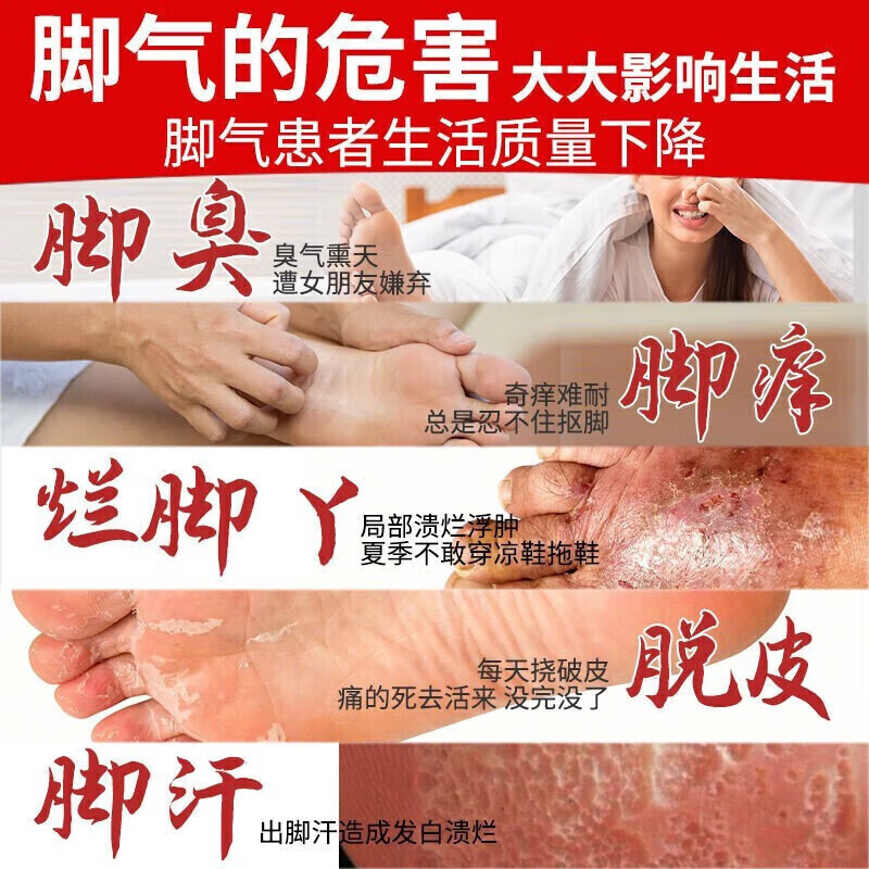 [韩都]克霉唑乳膏 脚气药止痒脱皮烂脚丫真菌感染根烂脚丫药脚趾缝烂痒专用的特新效期药治疗溃烂皮肤用药 1%*10g 1盒装 【医用脚气药】