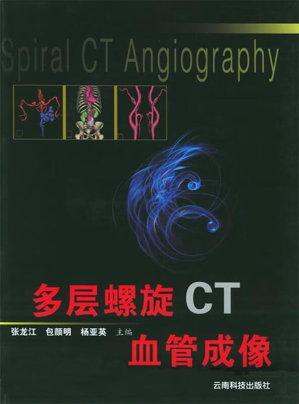 多层螺旋CT血管成像