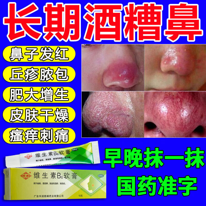 鼻头硬块黑头粉刺草莓鼻去痤疮鼻子红肿长痘 维生素b6软膏 【鼻头长痘