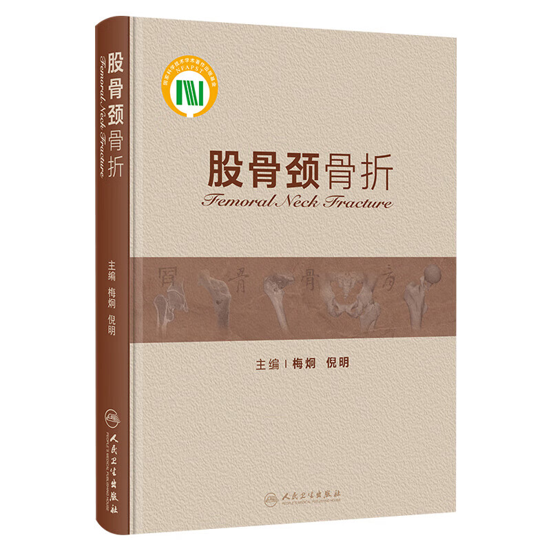 股骨颈骨折合并同侧股骨头骨折诊治参考指南 中老年髋骨骨折治疗预防