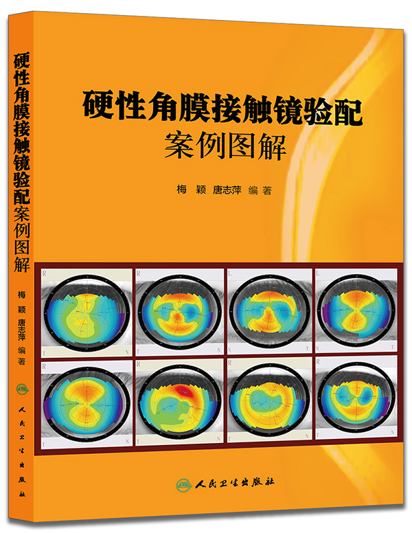 慢性角膜接触镜艾力图解【正版图书】
