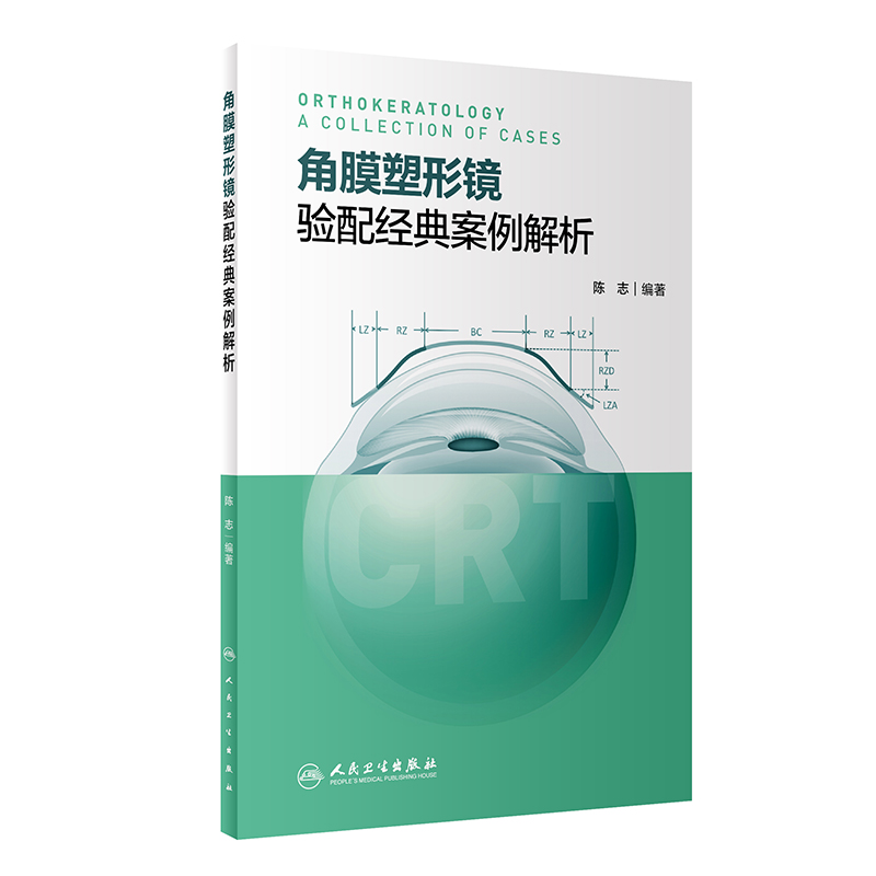 角膜塑形镜验配经典案例解析 crt角膜塑形镜简介与验配原则塑形镜验配