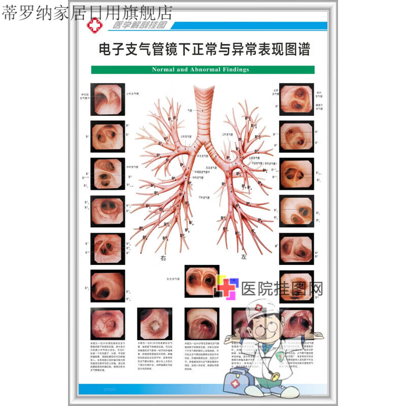 蒂罗纳医院呼吸科系列解剖挂图支气管镜检图谱图片海报定制 电子支
