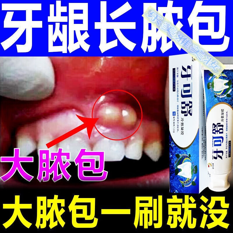 【牙龈起包】牙龈肿痛长脓包上火发i炎长泡牙龈炎牙周i炎牙可舒牙膏