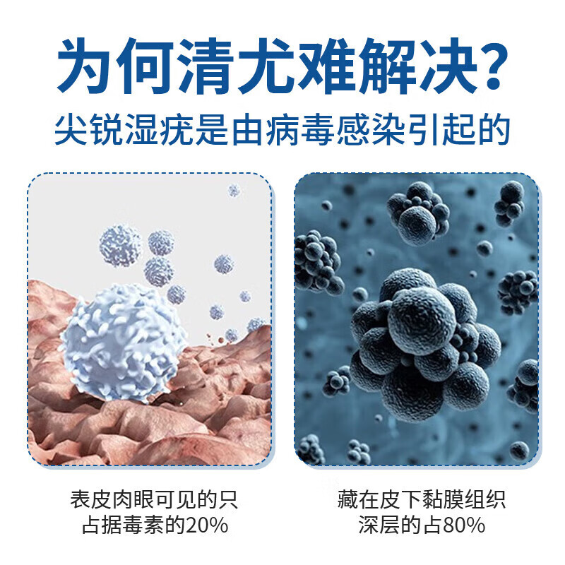 咪奎莫特乳膏5%医用祛疣型东京大药去除脖子小肉粒尖锐湿疣扁平疣 体验装[实发1支]