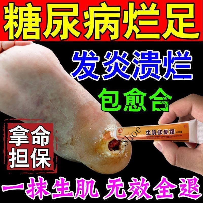 糖尿l病足膏老烂腿烂l脚褥l疮脉管炎皮肤伤口溃烂祛腐空洞褥l疮黑痂褥