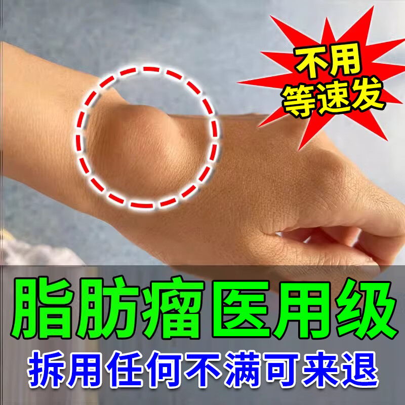 特傚非药神器36种皮下多发性脂非进口脂肪硬块皮下囊肿药监备案膏贴