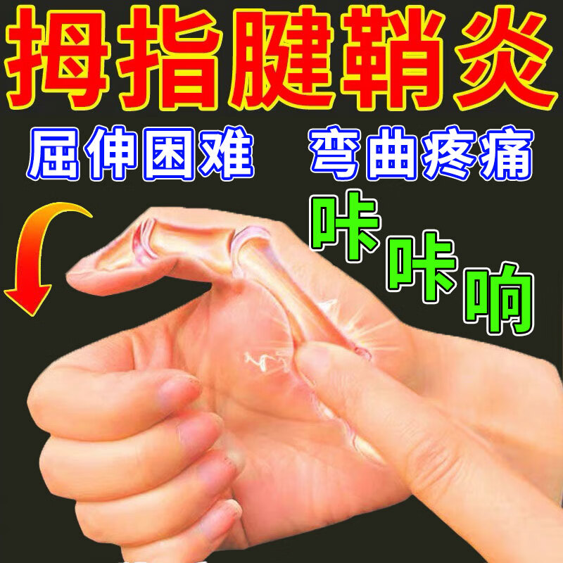 膏手指疼僵硬软膏键销炎大母一指cc 买32五盒装长期大拇指腱鞘炎专