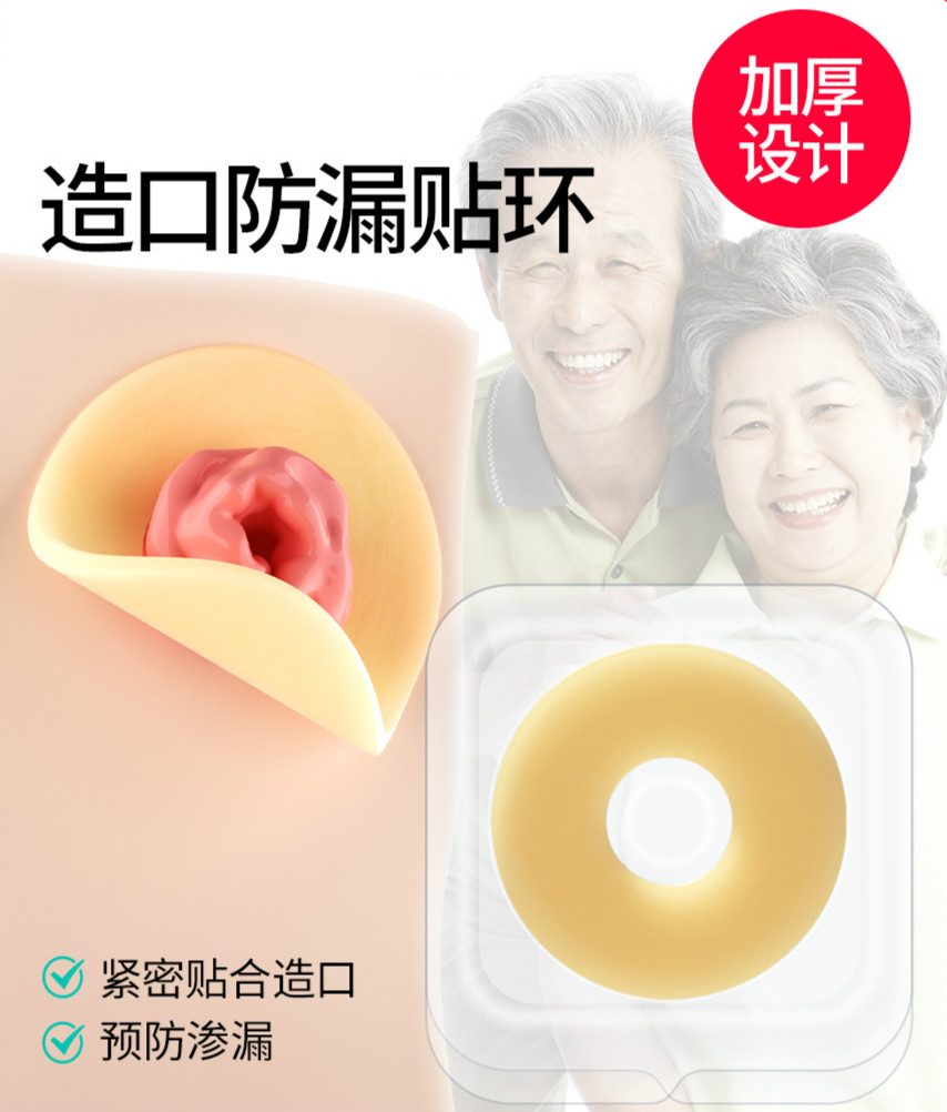 防漏膏6450 造口防漏圈防漏贴环 造口袋防漏环造口防漏 防漏贴环2mm