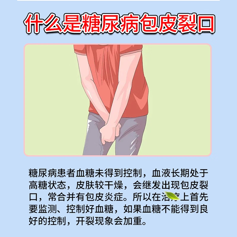 药健百瑞糖尿病包皮裂口炎症专用喷剂药促进愈合男性包皮开裂发红磨烂出血 单盒【体验装 不划算】