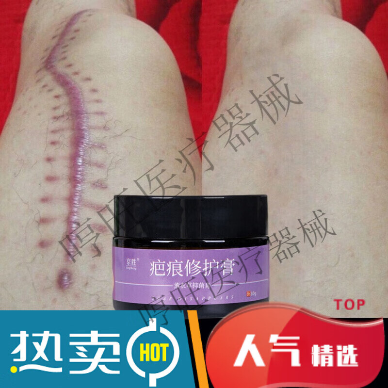疤痕修复膏摔伤抓伤疤痕体质胸前疙瘩疤凹凸疤烧伤烫伤缝针疤增生 1瓶